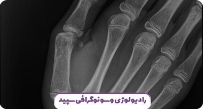 رادیوگرافی های عمومی و تخصصی